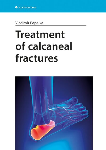 Treatment of calcaneal fractures