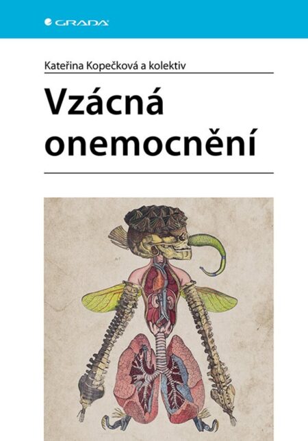Vzácná onemocnění